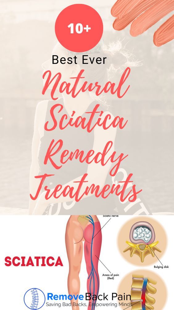 sciatica treatments