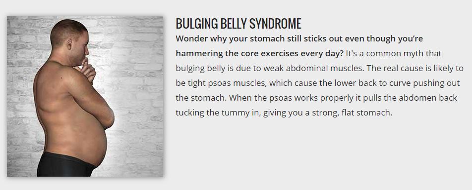bulging belly syndrome